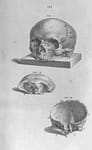 Skeleton torso, for Cheselden's Osteographia, Works of Art